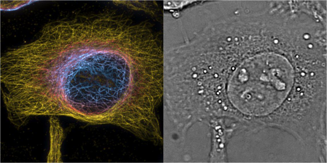 Hình ảnh 3D siêu phân giải đến cấp độ nanomet